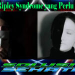 Seputar Ripley Syndrome yang Perlu Diketahui