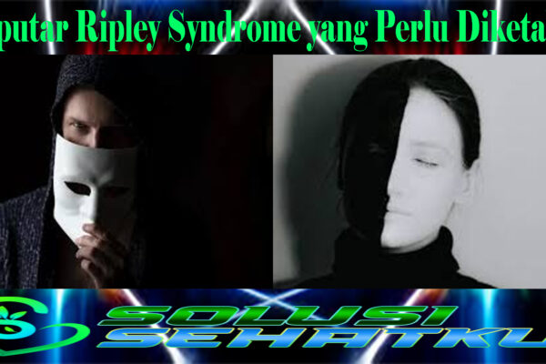 Seputar Ripley Syndrome yang Perlu Diketahui