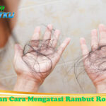 Pilihan Cara Mengatasi Rambut Rontok